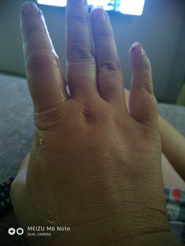 Причины боли в пальцах рук