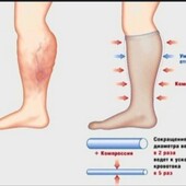 ♡Поддержка сосудам.Компрессионные гольфы.размер S,M,L- 1пара на ваш выбор.по ставке можно докупить