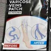 Пластир від варикозного розширення вен Varicose Veins Patch 10шт.